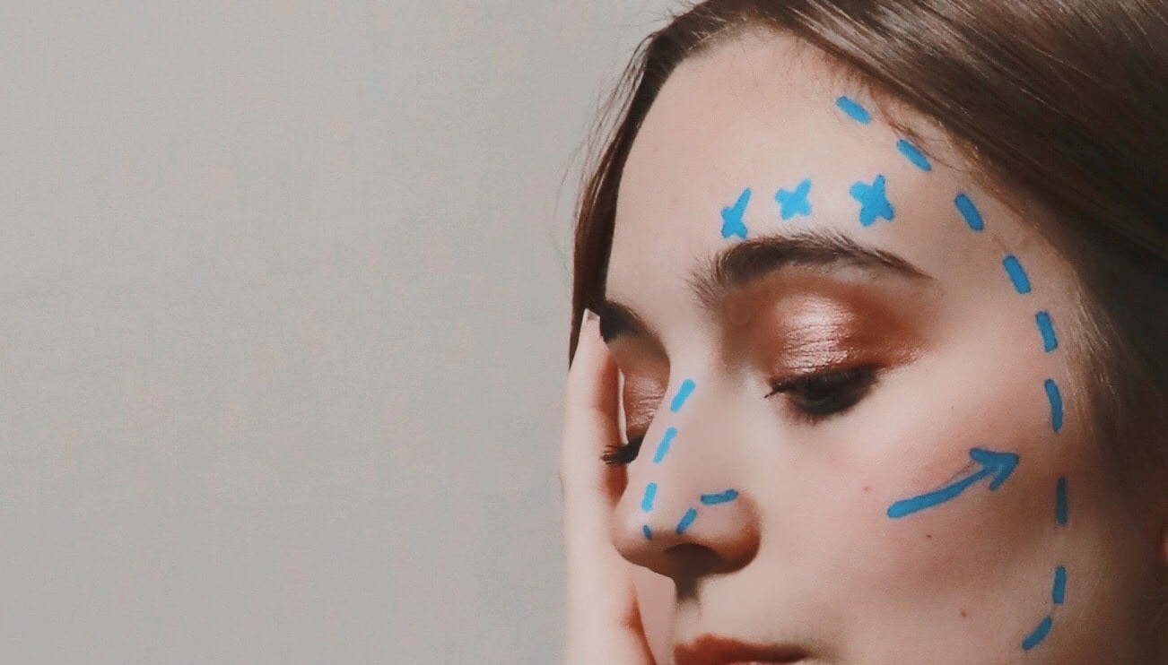 young woman with cosmetic surgery markings on her face